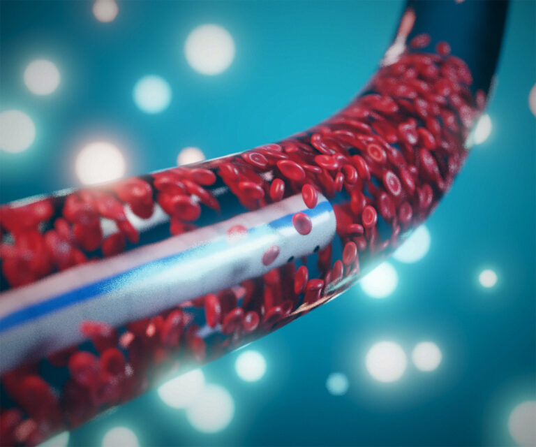 vascular-access-1